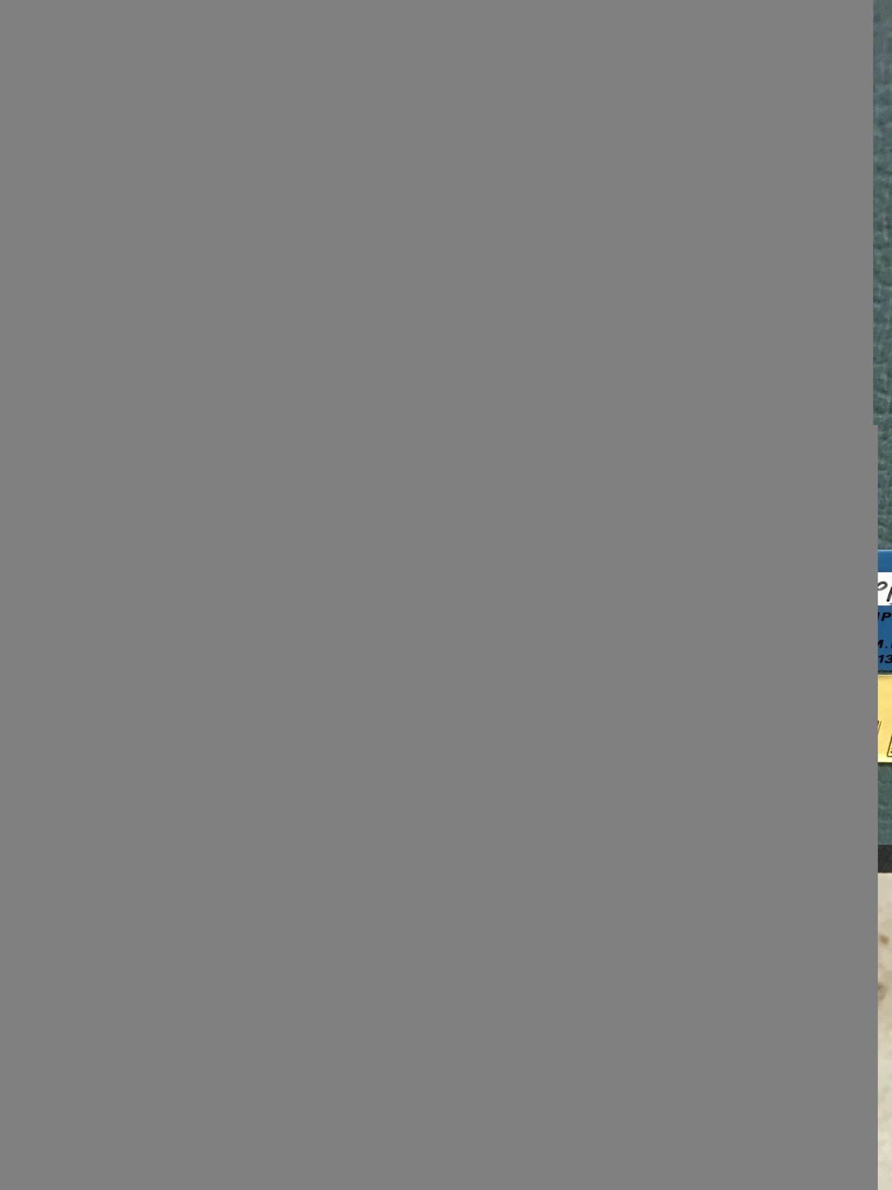 Image of Vitalograph Spirometer FEV Spirometry Breathing Medical Equipment