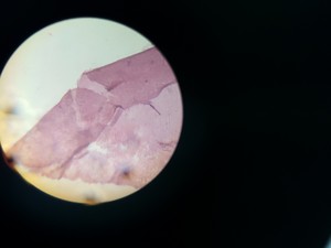 Thumbnail image of Carl Zeiss Binocular Laboratory Microscope w/ 3 Objectives Lab