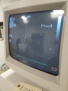 Thumbnail image of HP Sonos 2000 M2406A Ultrasound System Imaging Equipment Medical Healthcare