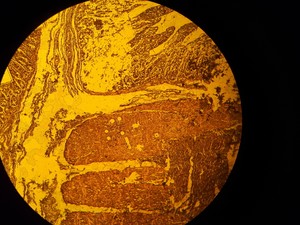 Thumbnail image of Leica Microscope Type 020-518.500 DM/LS II/98 with 5 x C Plan Objectives Lab