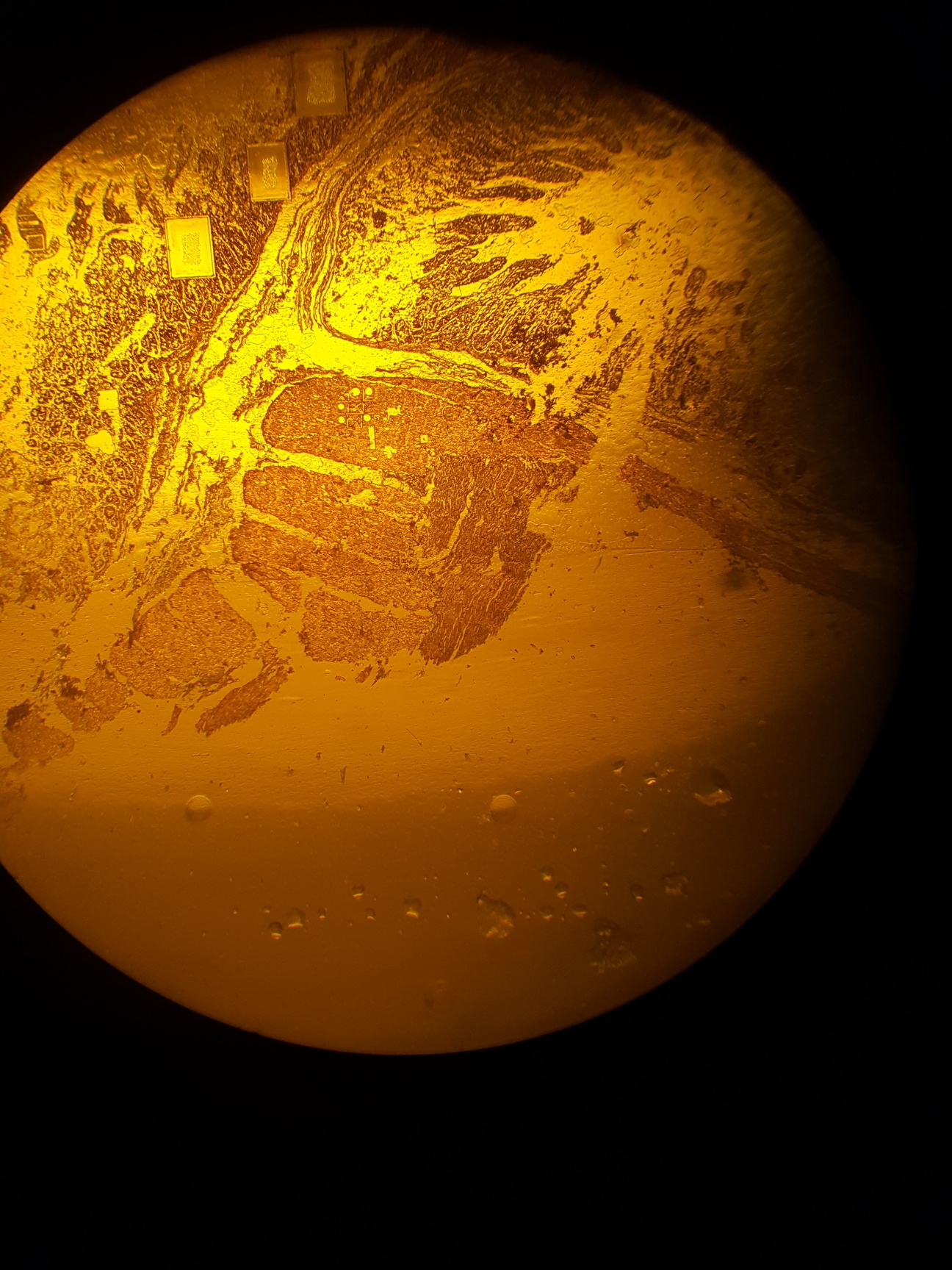 Image of Leica Microscope Type 020-518.500 DM/LS II/98 with 5 x C Plan Objectives Lab