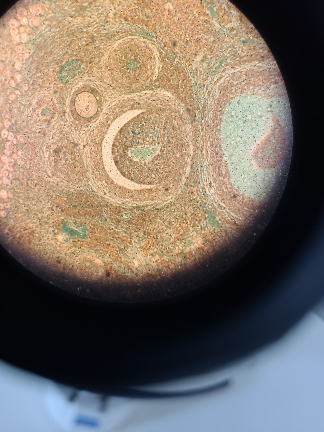 Image of Zeiss Axioplan 2 Imaging Trinocular Microscope w/ 3,2/0,07  160/- Objective Lab