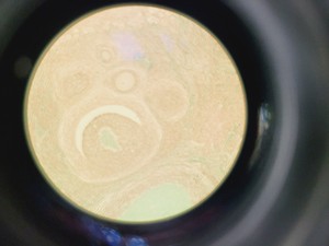 Thumbnail image of Zeiss Axiovert S100 Inverted Fluorescence Phase Contrast Microscope