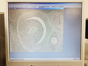 Thumbnail image of Olympus IX50/Arcturus LCM2106 PixCell 2E Microdissection Microscope System