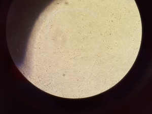 Thumbnail image of Olympus CKX41 Inverted Microscope w/ 2 x Objectives 20x/0.40 PhP  ∞/1/FN22 Lab