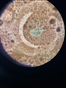 Thumbnail image of Leica DMRBE Fluorescence Trinocular Microscope & 4 x Objectives PL FLUOTAR Lab