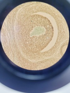 Thumbnail image of Optika XDS-3 Inverted Microscope w/ 3x Objectives PH 40X/6.0 20X0.40 10X0.25    