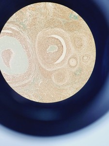 Thumbnail image of Optika XDS-3 Inverted Microscope w/ 3x Objectives PH 40X/6.0 20X0.40 10X0.25    