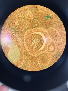 Thumbnail image of Olympus BX40 Clinical Grade Microscope System with Software Lab