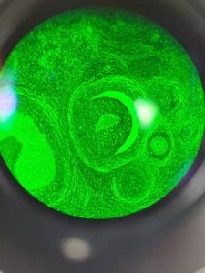 Thumbnail image of Olympus BX40 Clinical Grade Microscope System with Software Lab