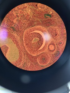 Thumbnail image of Olympus BX40 Clinical Grade Microscope System with Software Lab