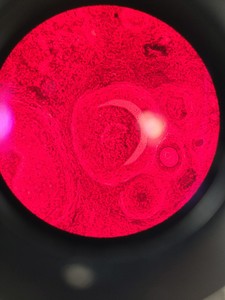Thumbnail image of Olympus BX40 Clinical Grade Microscope System with Software Lab