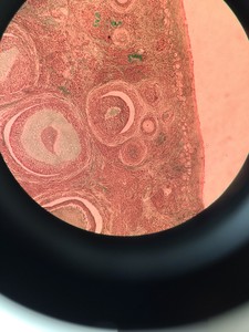 Thumbnail image of Reichert-Jung Polyvar 300602 Microscope & 4 Objectives - Austria 4, 10, 25, 40 