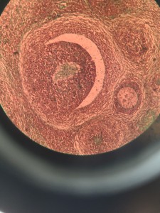 Thumbnail image of Reichert-Jung Polyvar 300602 Microscope & 4 Objectives - Austria 4, 10, 25, 40 
