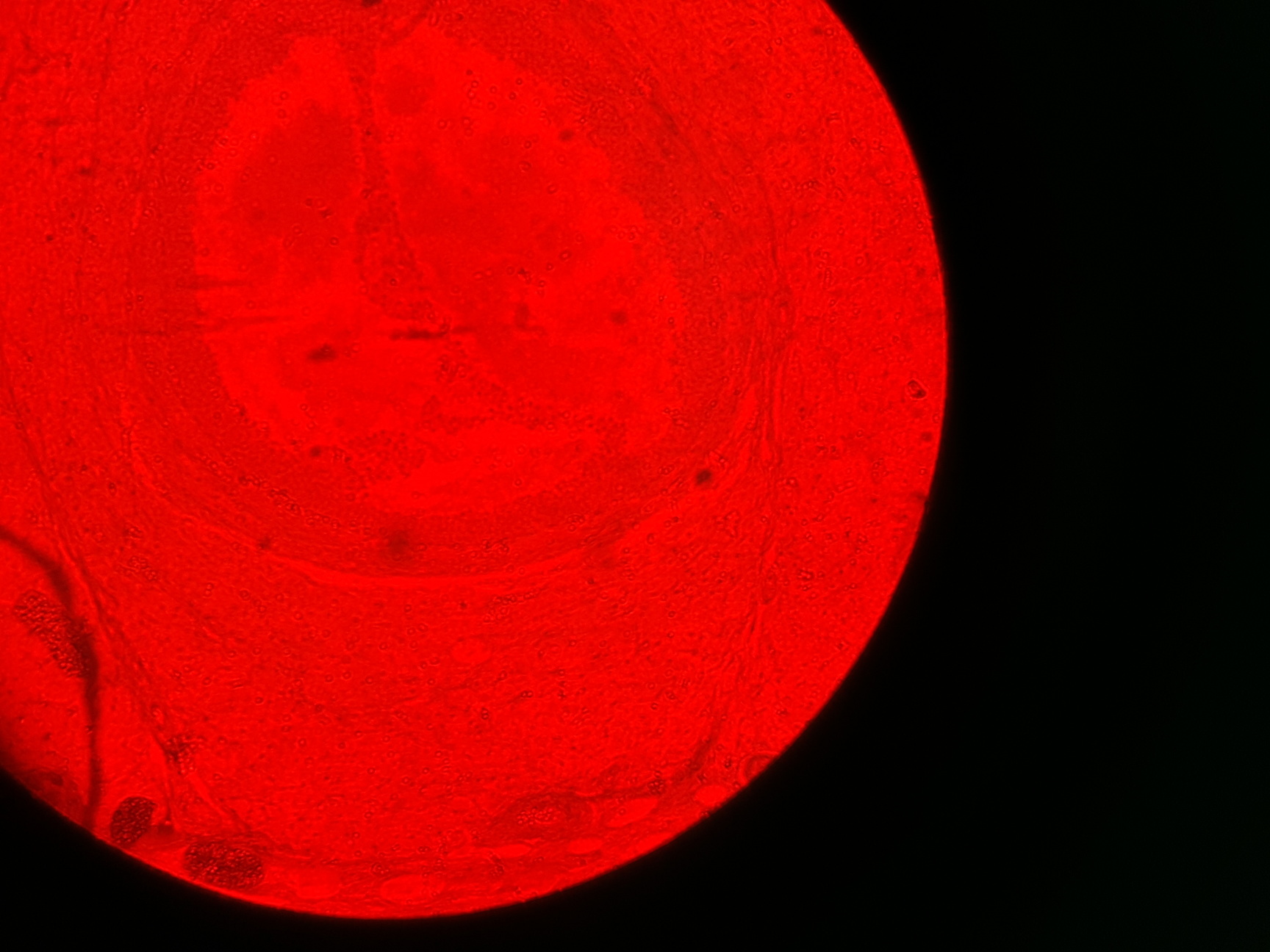 Image of Olympus BH-2 Microscope w/ 3 x Objectives - DPlan 10 0.25 160/0.17, SPlan Apo 