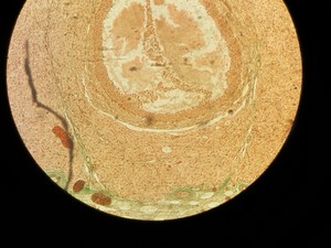 Thumbnail image of Olympus BH-2 Microscope w/ 3 x Objectives - DPlan 10 0.25 160/0.17, SPlan Apo 