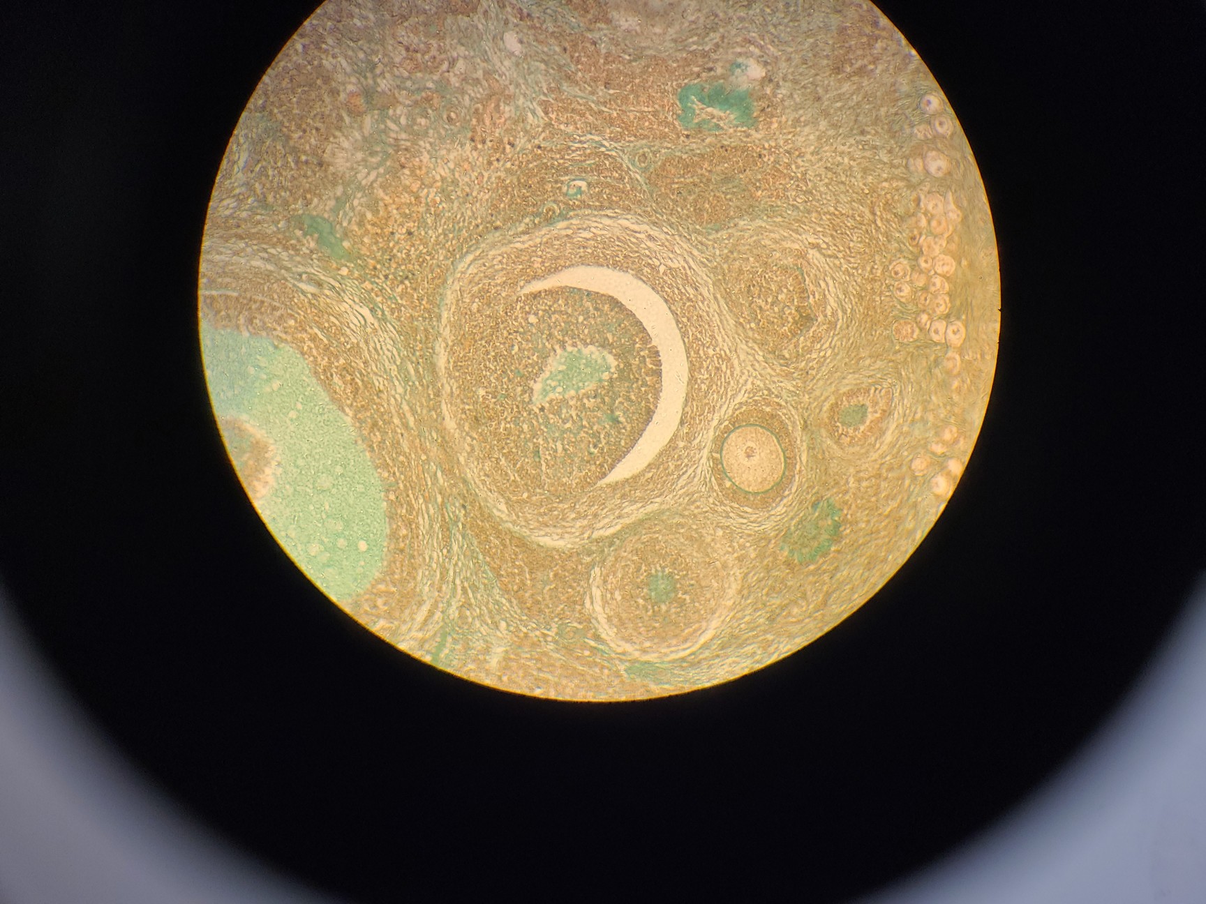 Image of Ceti Inverso TC100 LED Inverted Biological Microscope + FI Model: 3660.8000 Lab 