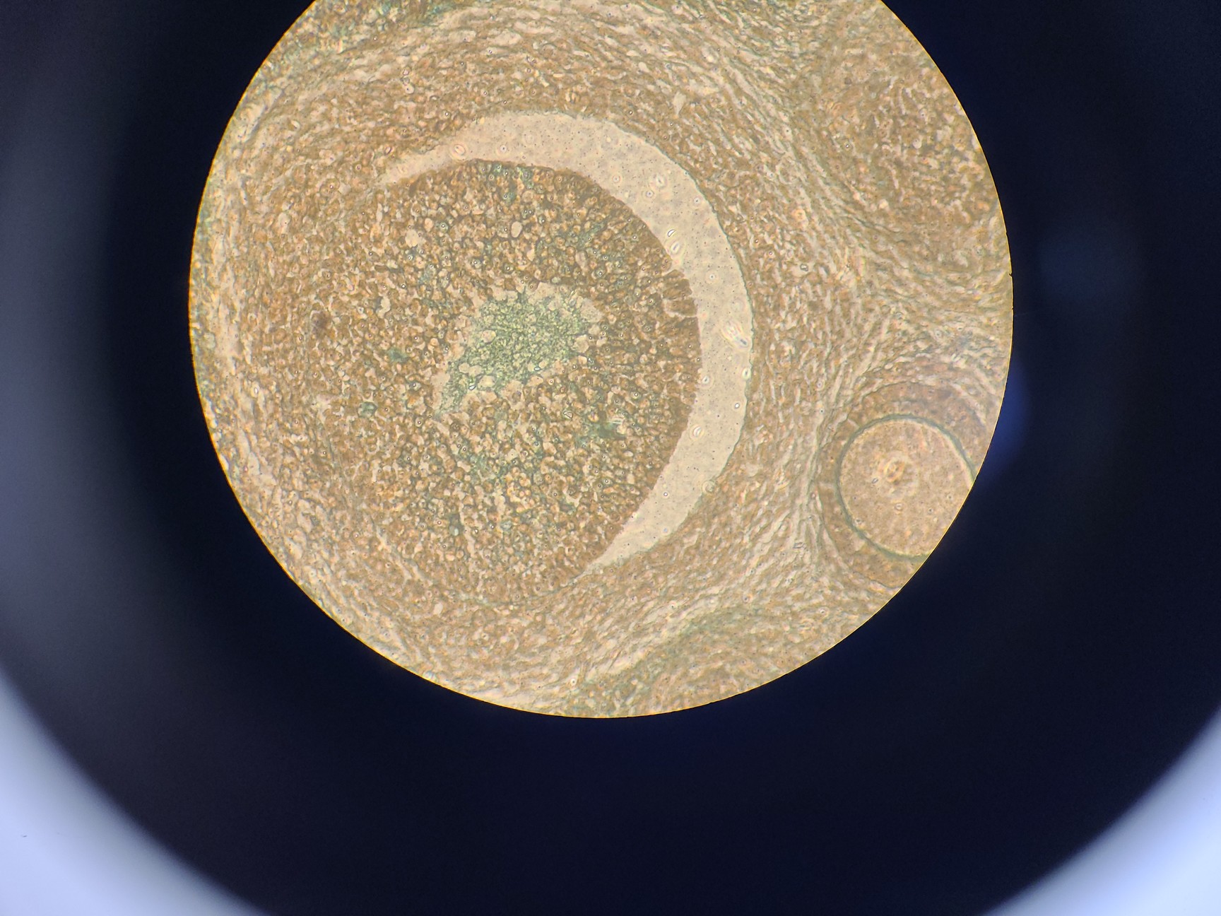 Image of Ceti Inverso TC100 LED Inverted Biological Microscope + FI Model: 3660.8000 Lab 