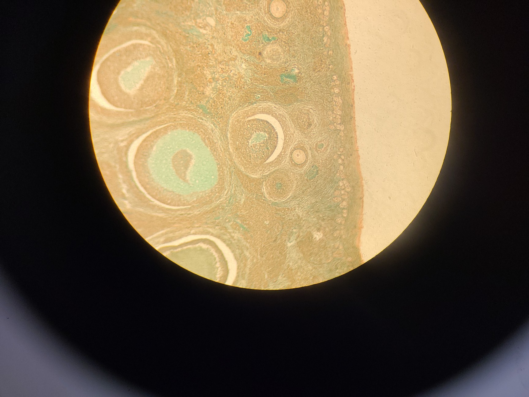 Image of Ceti Inverso TC100 LED Inverted Biological Microscope + FI Model: 3660.8000 Lab 