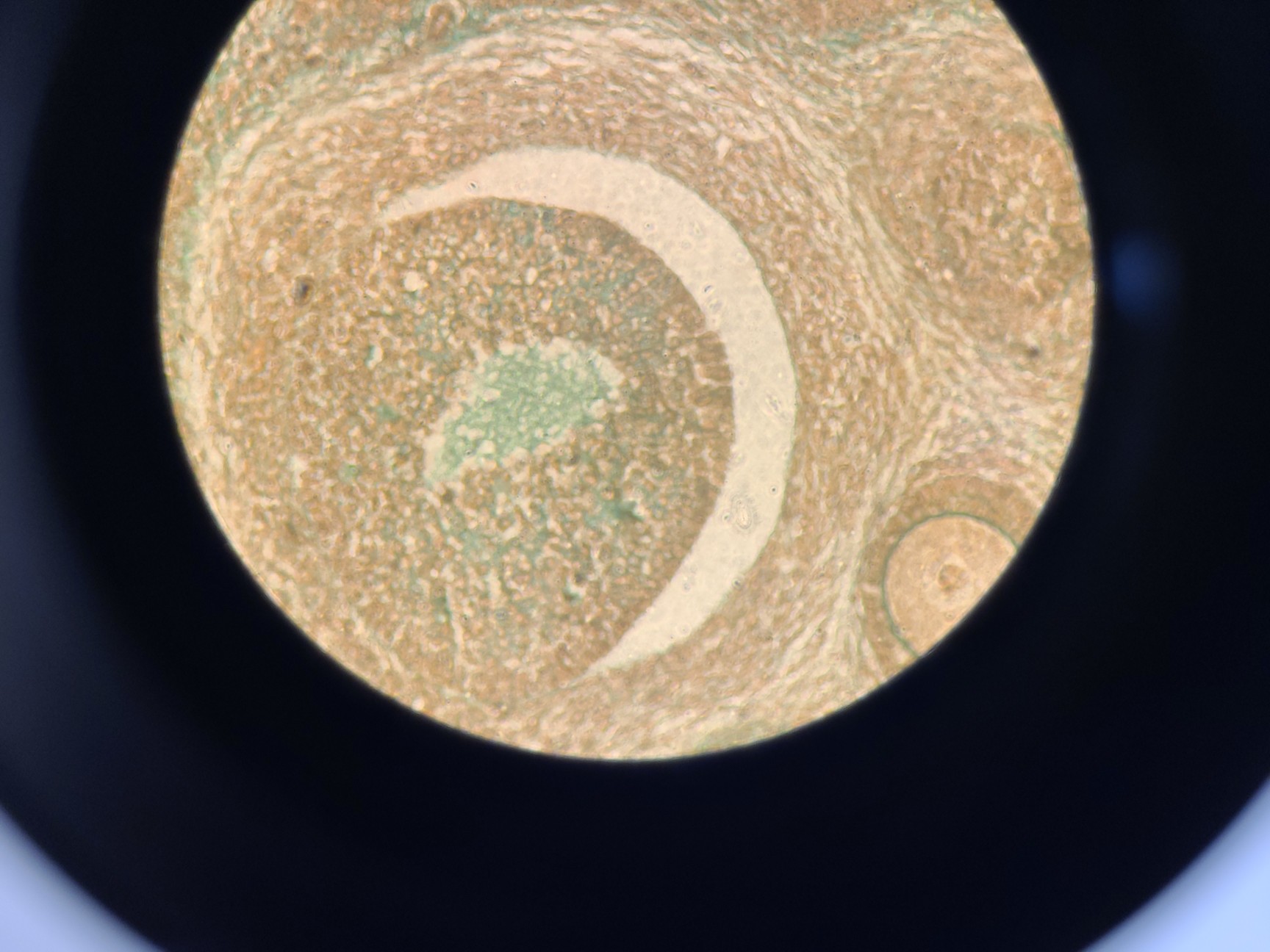 Image of Ceti Inverso TC100 LED Inverted Biological Microscope + FI Model: 3660.8000 Lab 