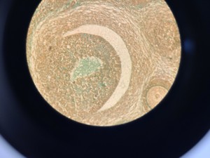 Thumbnail image of Ceti Inverso TC100 LED Inverted Biological Microscope + FI Model: 3660.8000 Lab 