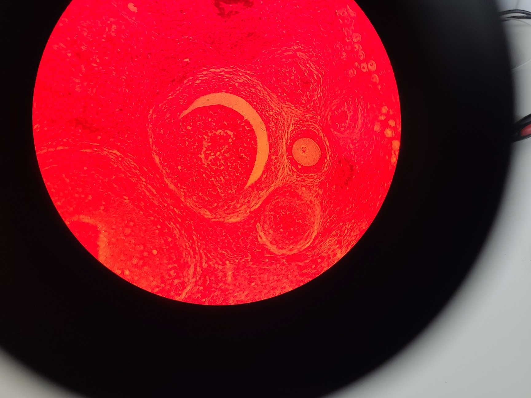 Image of Ceti Inverso TC100 LED Inverted Biological Microscope + FI Model: 3660.8000 Lab 