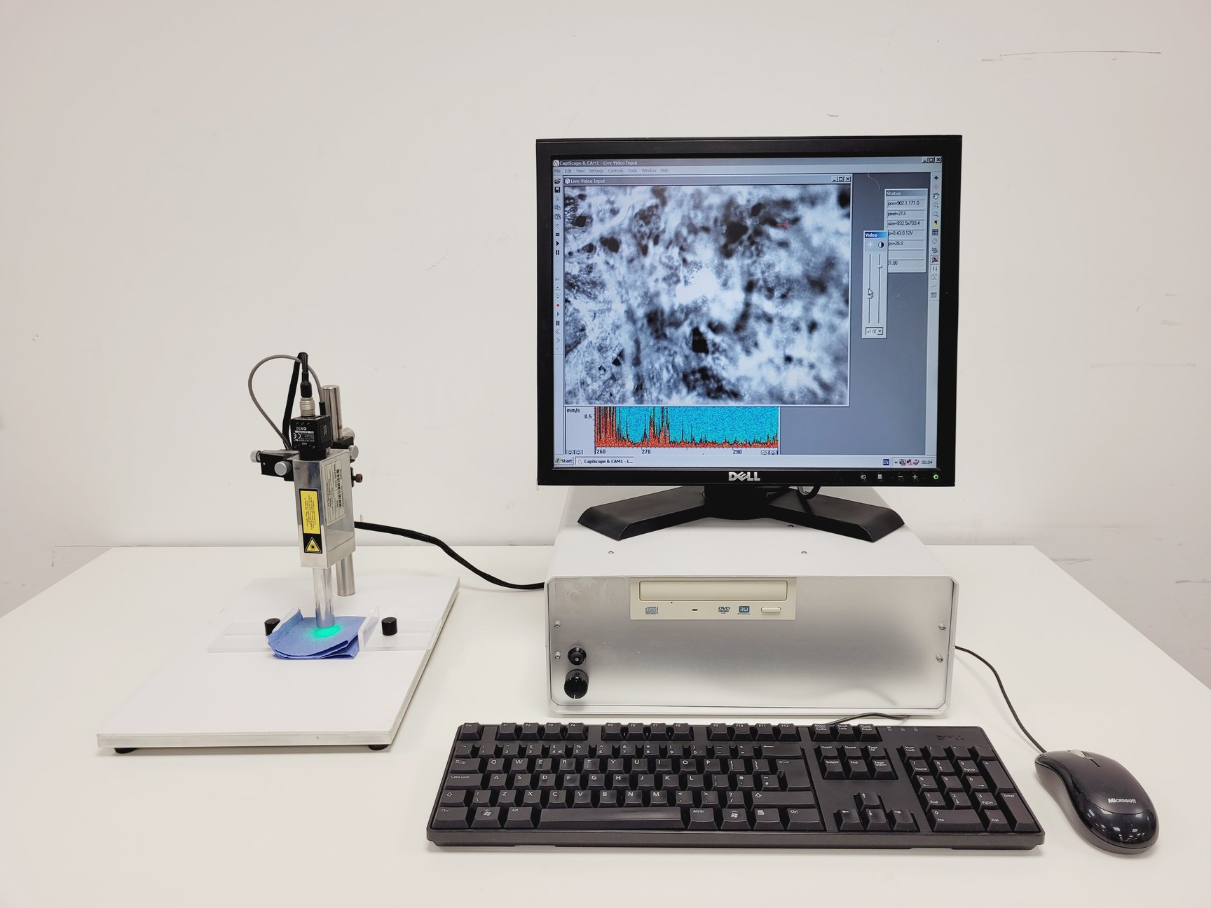 Image of CapiScope VCS Video Capillaroscopy System  - CAM1, PU - With PC & Software Lab