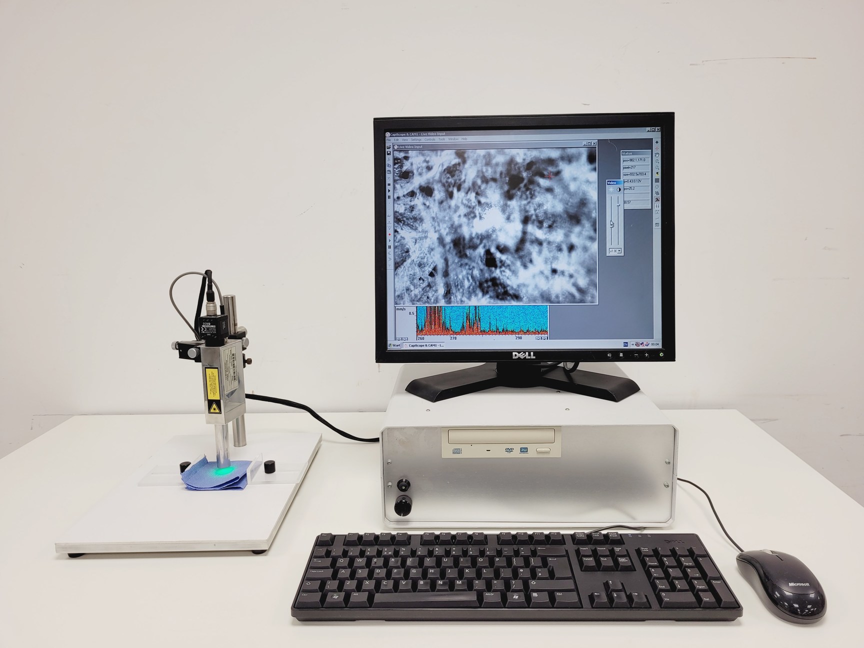 Image of CapiScope VCS Video Capillaroscopy System  - CAM1, PU - With PC & Software Lab