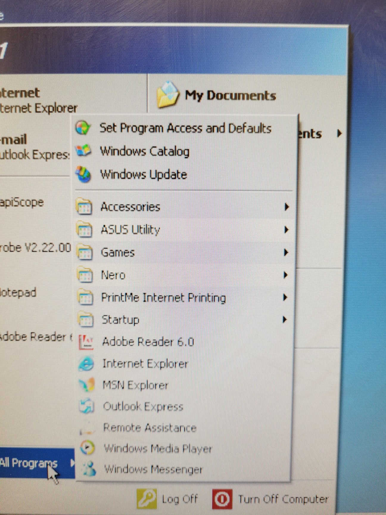 Image of CapiScope VCS Video Capillaroscopy System  - CAM1, PU - With PC & Software Lab