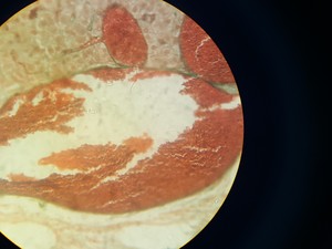 Thumbnail image of GX Microscopes Trinocular Microscope with Q Imaging QICAM & 4 x Objectives Lab