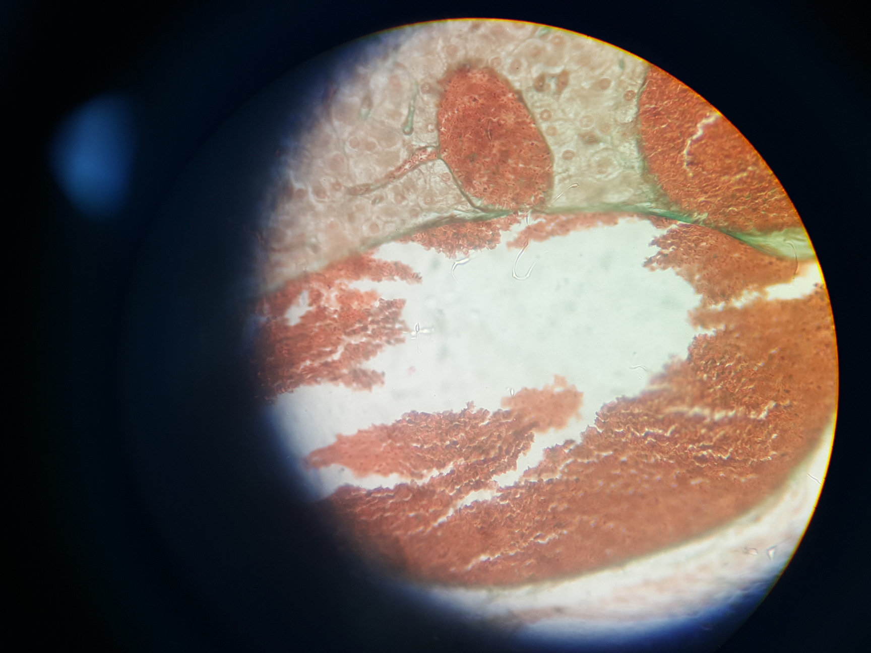 Image of GX Microscopes Trinocular Microscope with Q Imaging QICAM & 4 x Objectives Lab