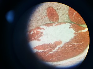 Thumbnail image of GX Microscopes Trinocular Microscope with Q Imaging QICAM & 4 x Objectives Lab