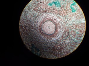 Thumbnail image of Motic B Series Compound Monocular Laboratory Microscope with 4 x Objectives Lab