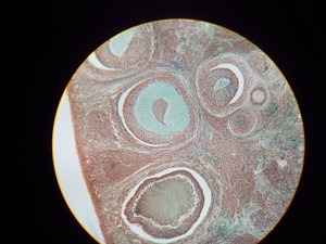 Thumbnail image of Motic B Series Compound Monocular Laboratory Microscope with 4 x Objectives Lab