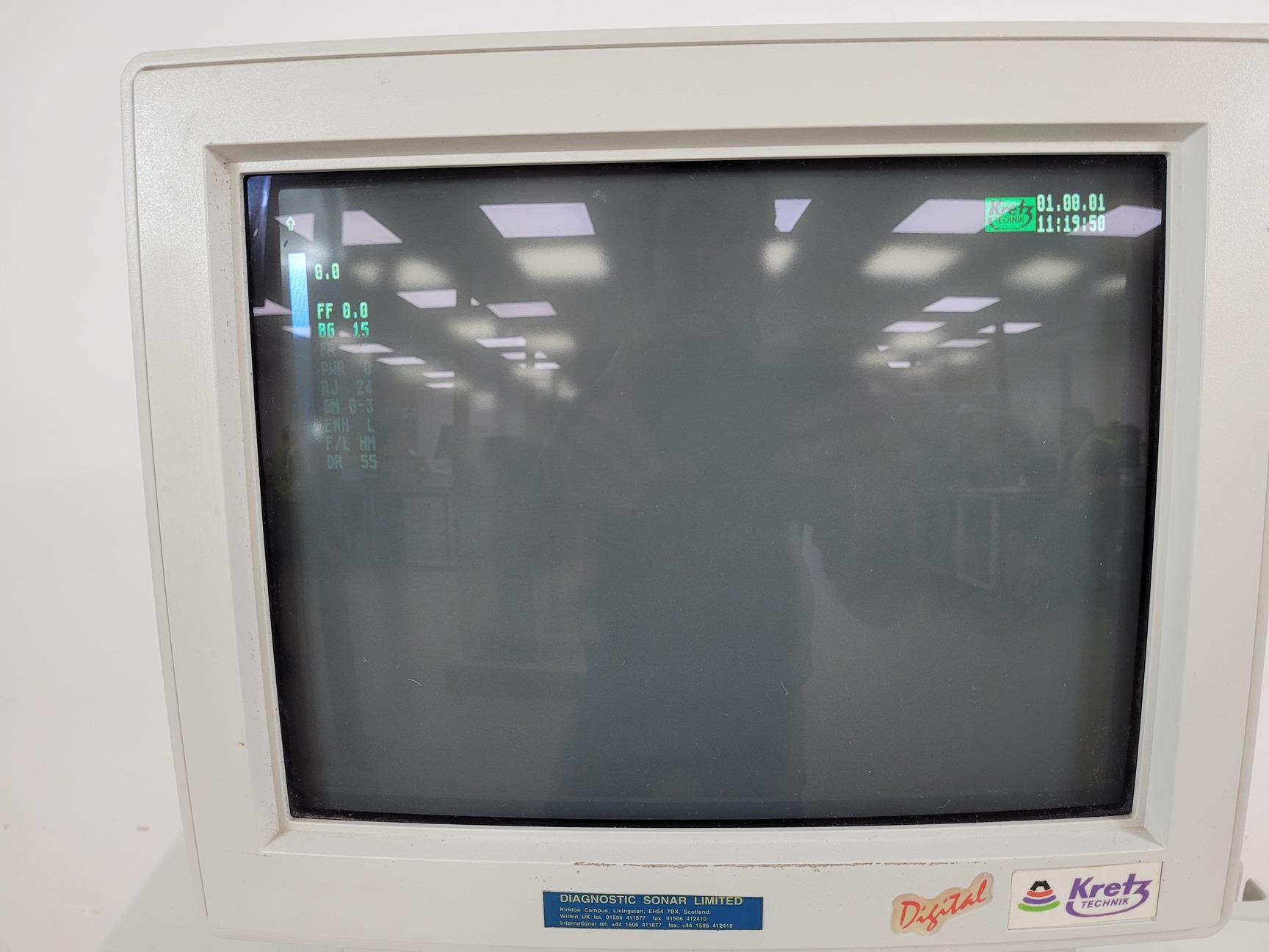 Image of Medison Voluson 530D Ultrasound Machine Lab Spares/Repairs