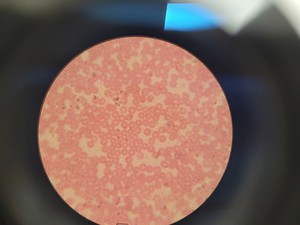 Thumbnail image of Leica ATC 2000 Compound Binocular Microscope with 4 x Achro Objectives Lab