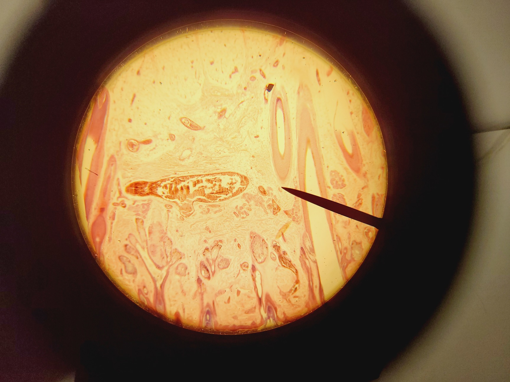 Image of Olympus CH-2 CHS Microscope with 4 x Objectives SPlan A4 FLU Lab