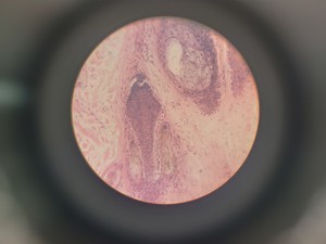 Thumbnail image of Nachet France NS 200 Binocular Compound Microscope with 3 x Objectives Lab