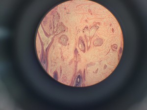 Thumbnail image of Nachet France NS 200 Binocular Compound Microscope with 3 x Objectives Lab