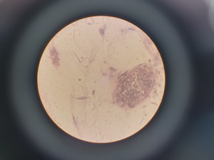 Thumbnail image of Nachet France NS 200 Binocular Compound Microscope with 3 x Objectives Lab