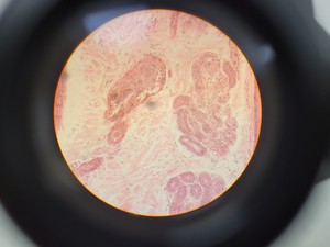 Thumbnail image of Ceti TC-100 Inverted Fluorescence Microscope  Model: Inverso 3650.000 Lab