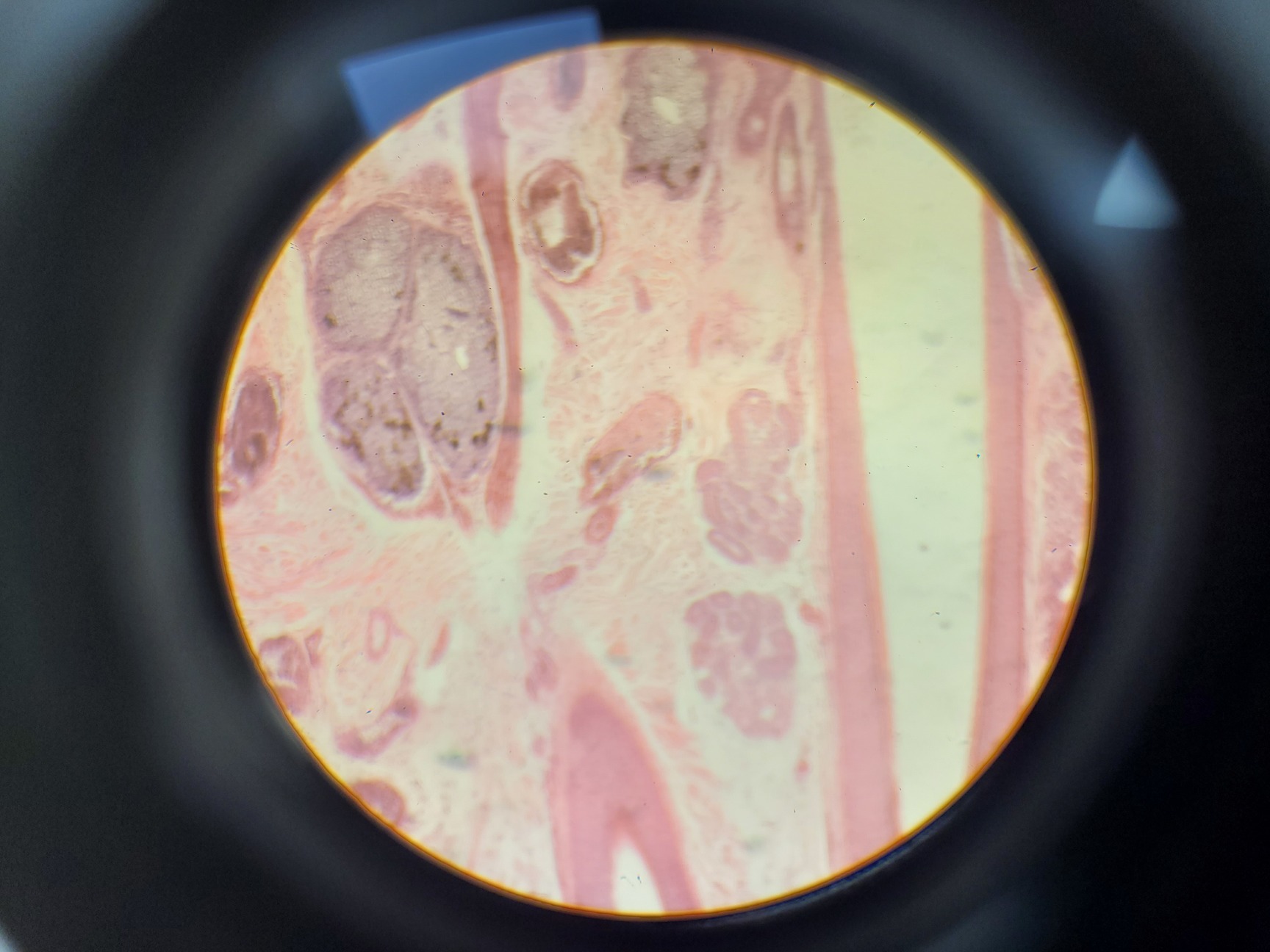 Image of Ceti TC-100 Inverted Fluorescence Microscope  Model: Inverso 3650.000 Lab