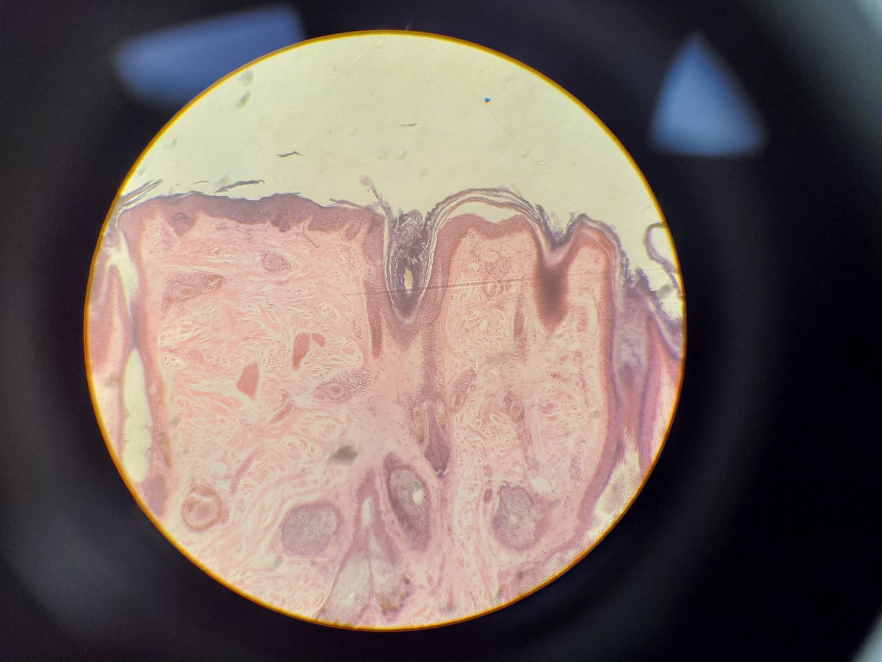 Image of Ceti TC-100 Inverso 3650.000 Inverted Fluorescence Microscope Lab