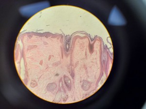 Thumbnail image of Ceti TC-100 Inverso 3650.000 Inverted Fluorescence Microscope Lab