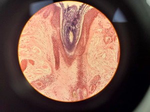 Thumbnail image of Ceti TC-100 Inverso 3650.000 Inverted Fluorescence Microscope Lab