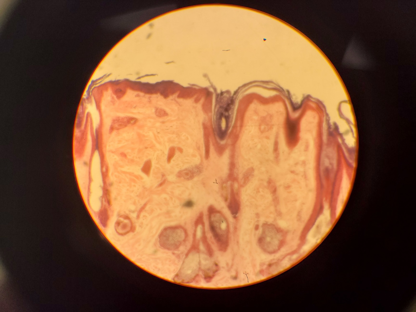 Image of Ceti TC-100 Inverso 3650.000 Inverted Fluorescence Microscope Lab