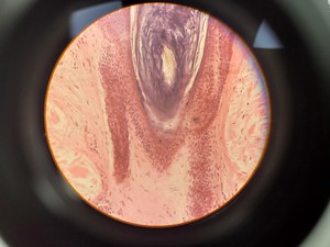 Thumbnail image of Ceti TC-100 Inverso 3650.000 Inverted Fluorescence Microscope Lab