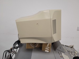 Thumbnail image of Aloka ProSound Ultrasound Diagnostic System  Model: SSD-5500 Lab Spares/Repairs