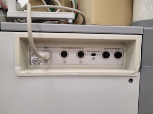 Thumbnail image of Aloka ProSound Ultrasound Diagnostic System  Model: SSD-5500 Lab Spares/Repairs