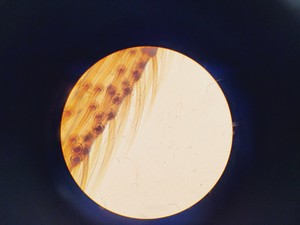 Thumbnail image of Kyowa Tokyo Compound Microscope with 4 x Objectives PL 20 Para Phase Lab